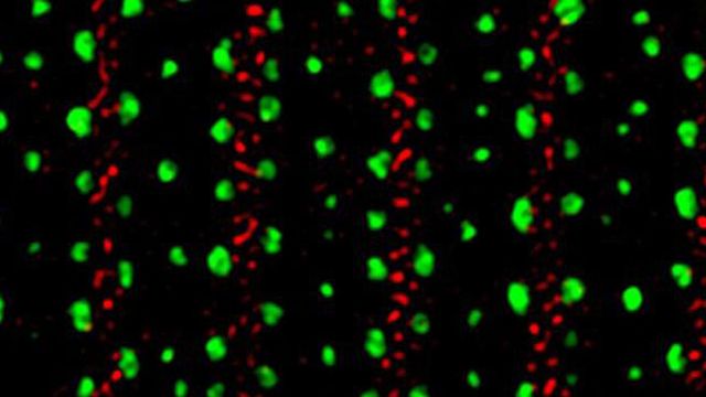 Super resolution microscopy reveals two roundworm collagens labeled in red and green. 