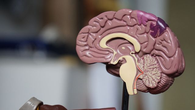 A 3D model of a human brain. 