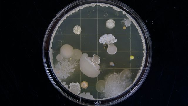 Bacteria bloom in a petri dish. 