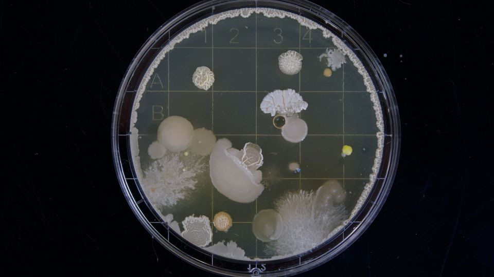 Bacteria bloom in a petri dish.